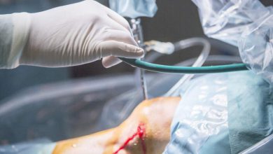 Sutura do menisco quando ela é indicada