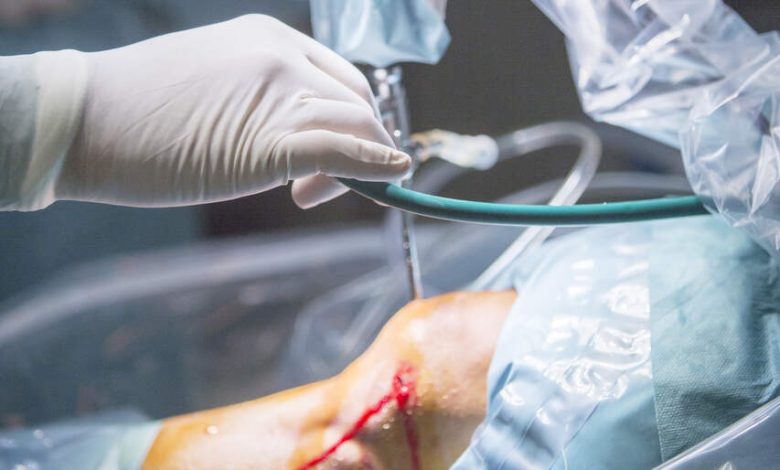 Sutura do menisco quando ela é indicada