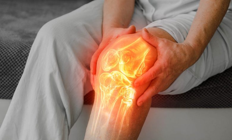 Artrose no joelho Veja quando pode ser hora de pensar em uma prótese